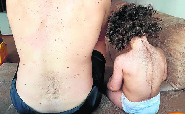 Tomar omeprazol embarazada puede una mujer